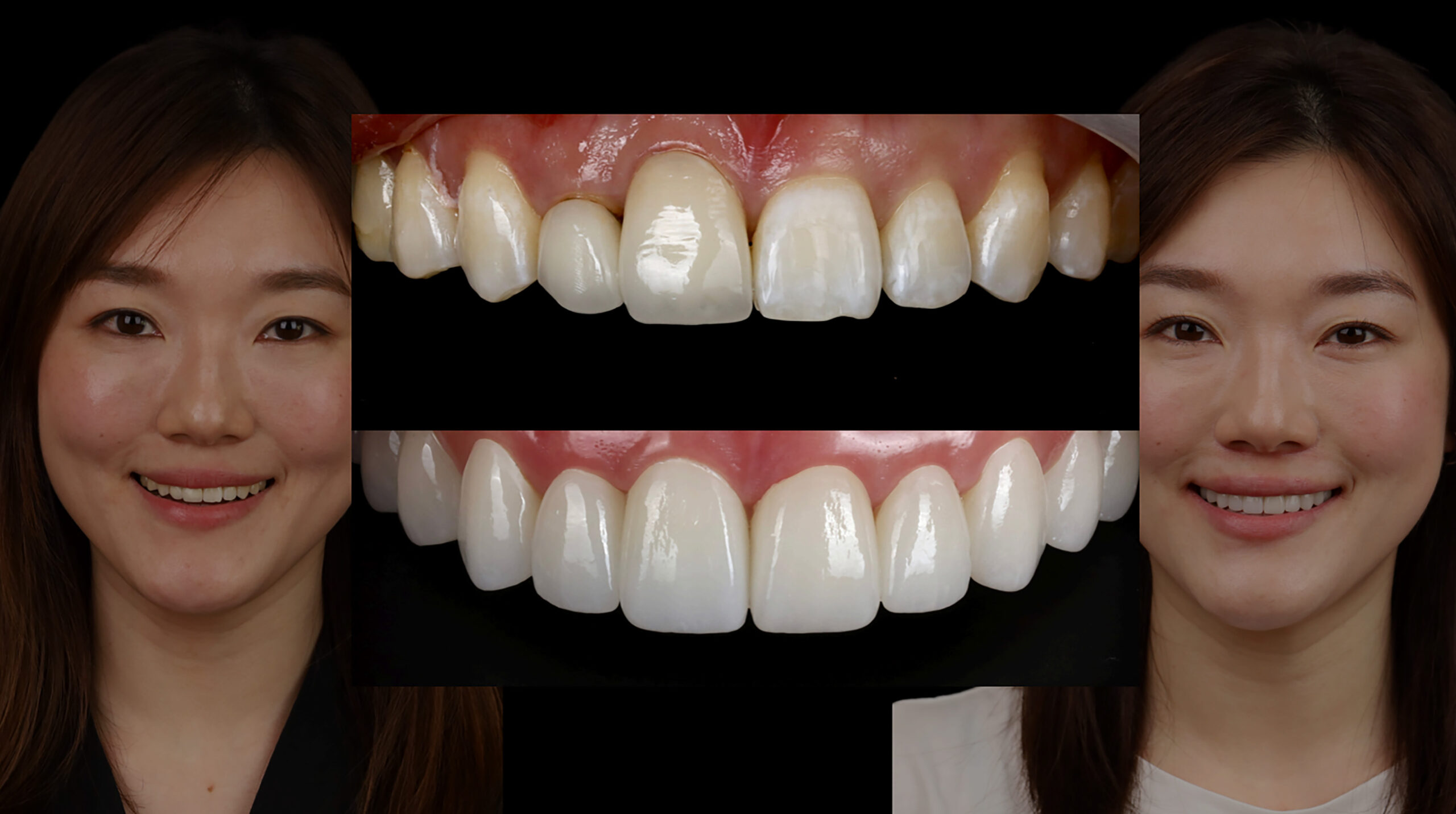 Before_After-1-scaled.jpg