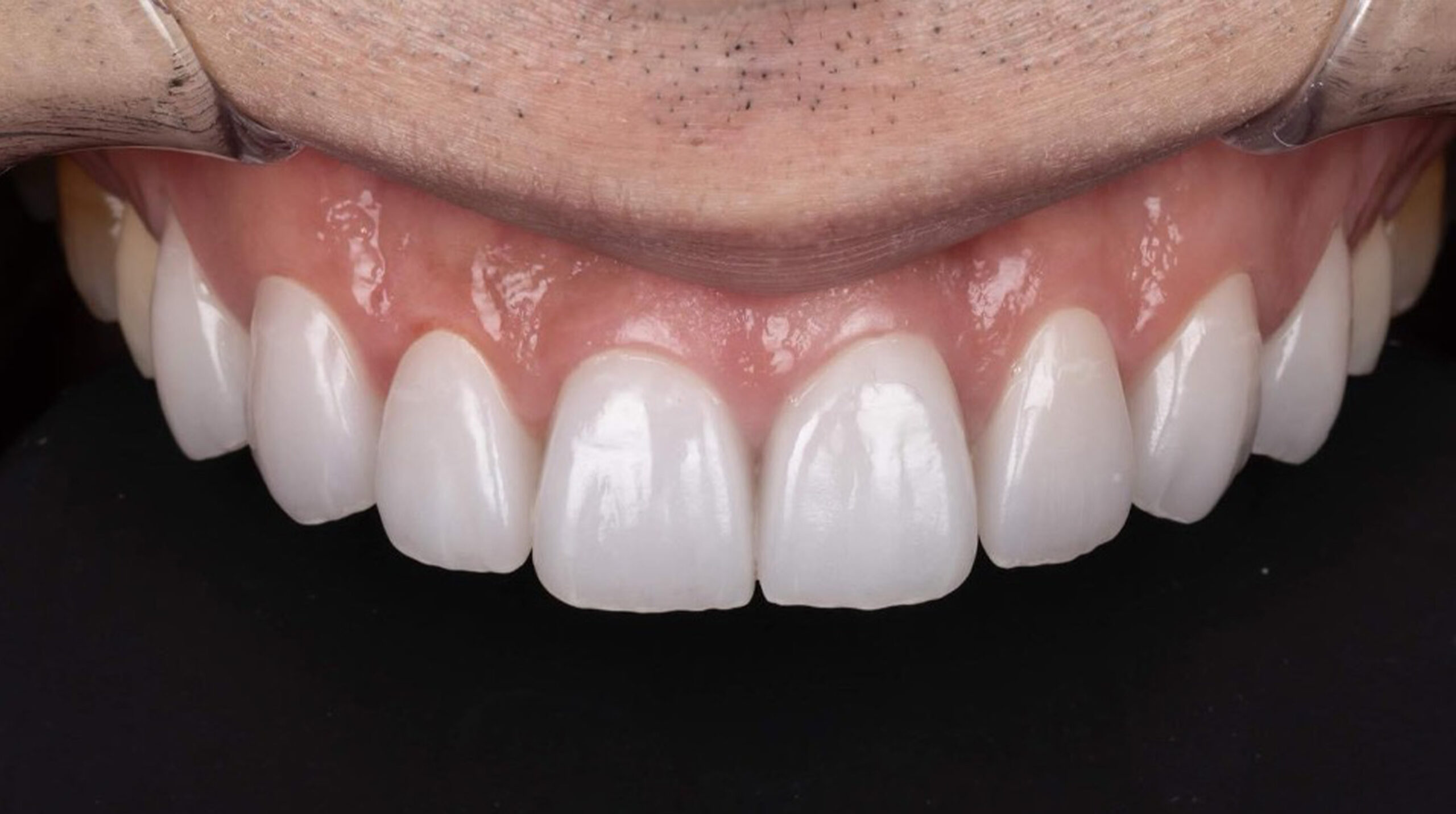 Case-ZIRNEER-2-scaled.jpg