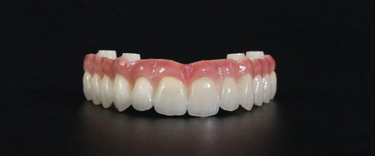 Full-Zirconia-Arch_Mobile