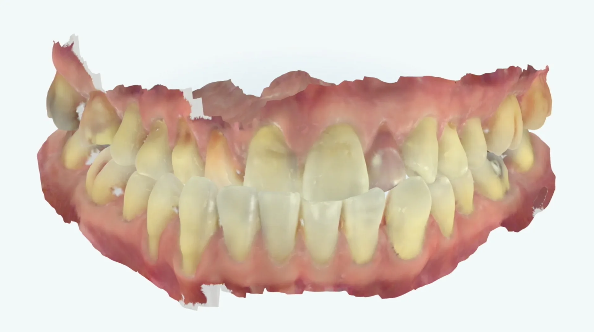 Second-Day_TrioClear-Align-and-Restore_Slider_4-scaled