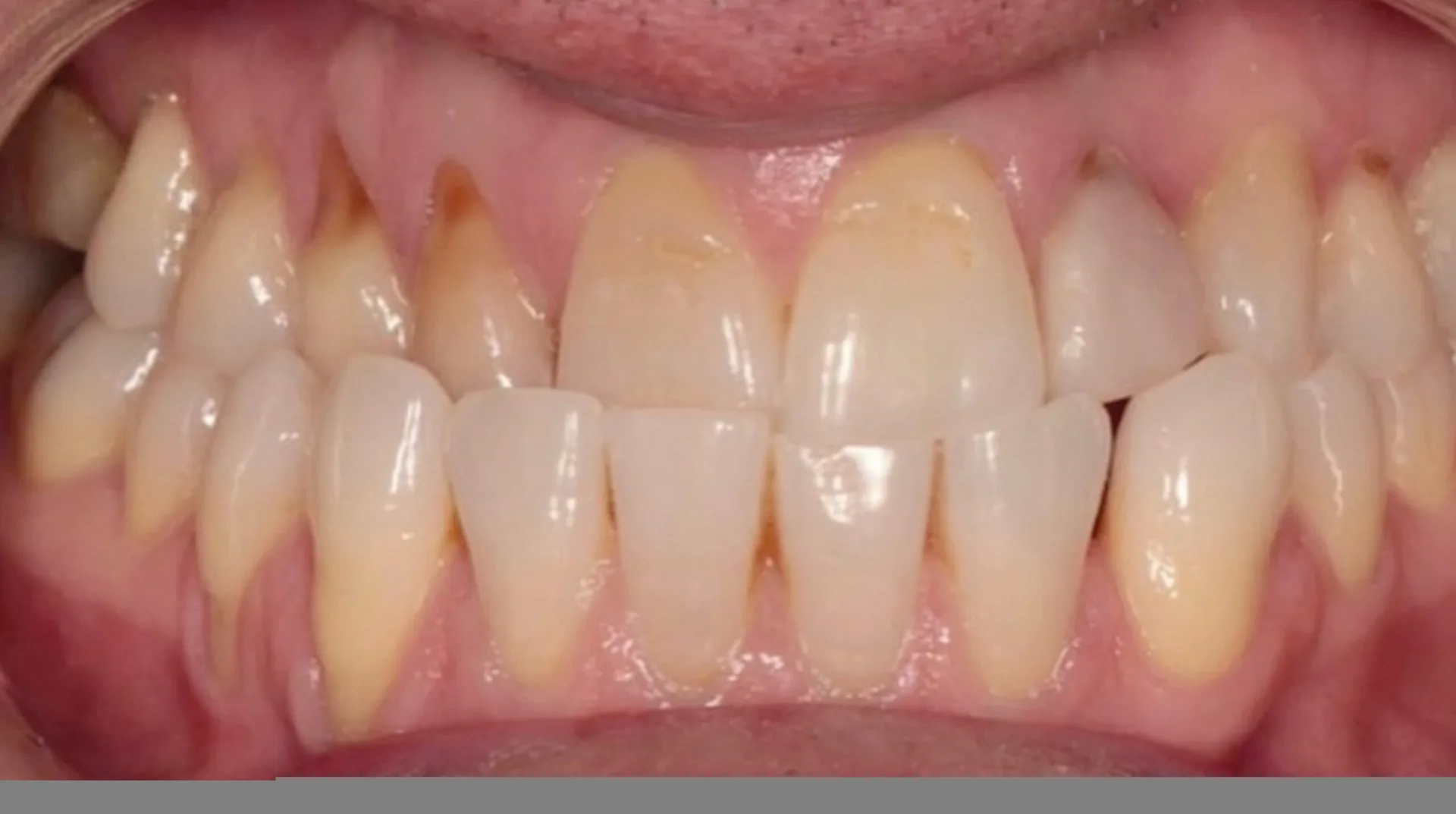 Second-Day_TrioClear-Align-and-Restore_Slider_8-scaled