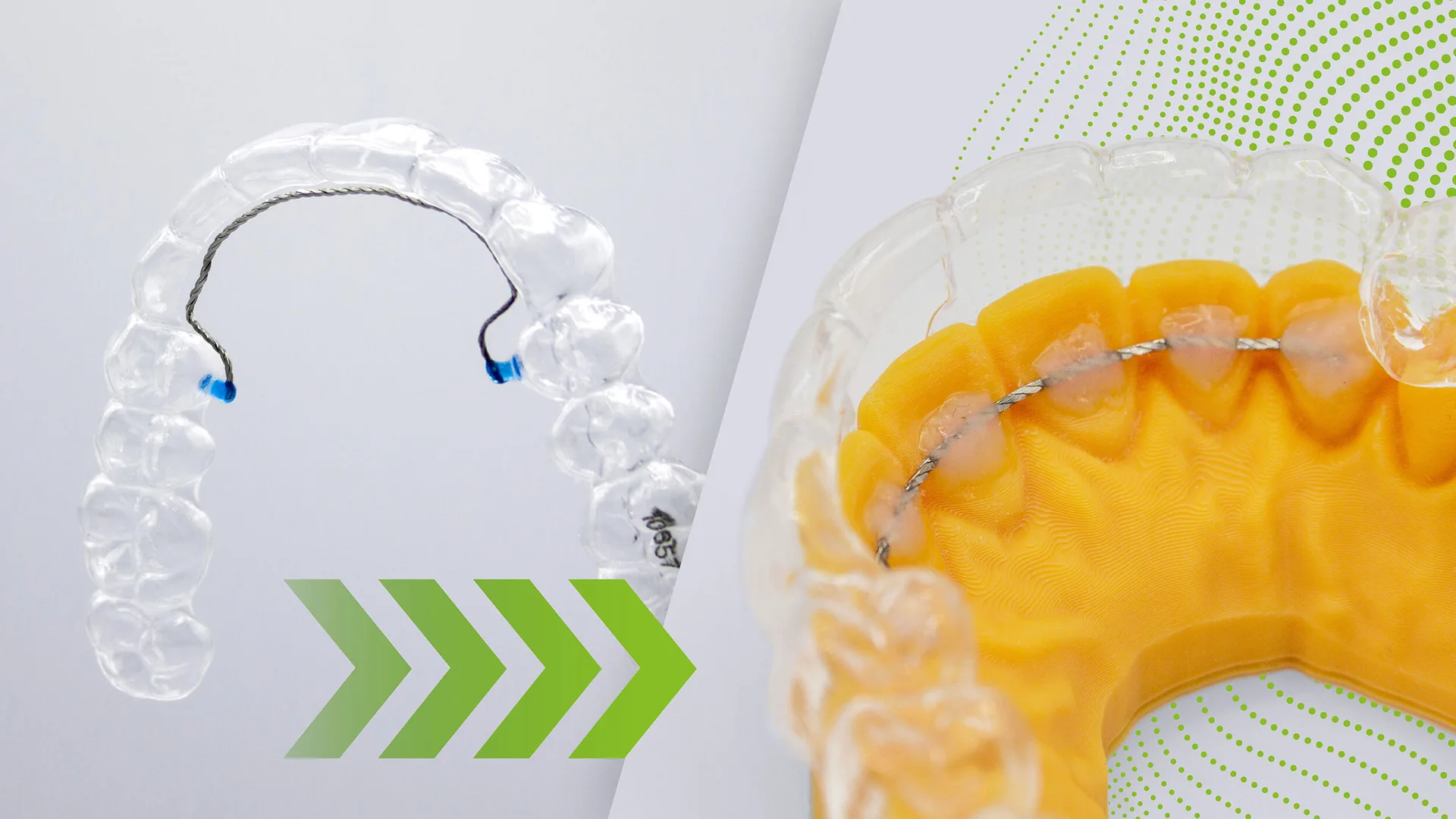 w49-combi-retainer-visual-resized